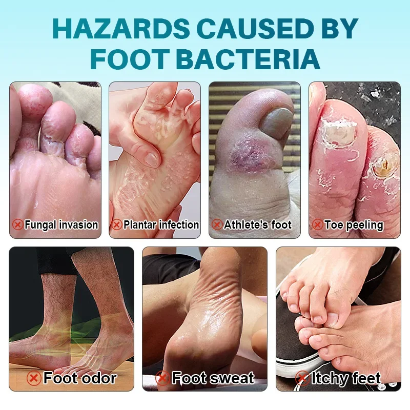 Foot Deodorant Cream Foot Odor Bacteriostasis Antipruritic Athlete\'s Foot Ointment Skin Topical Cream Personal Health Care