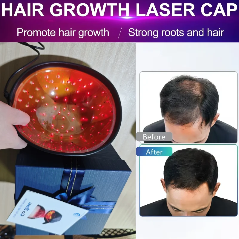 HLKGO 650nm Medical LLLT Hair Growth Cap, 96 Diodes Laser for Androgenetic Alopecia Treatment Fast Result - view 5