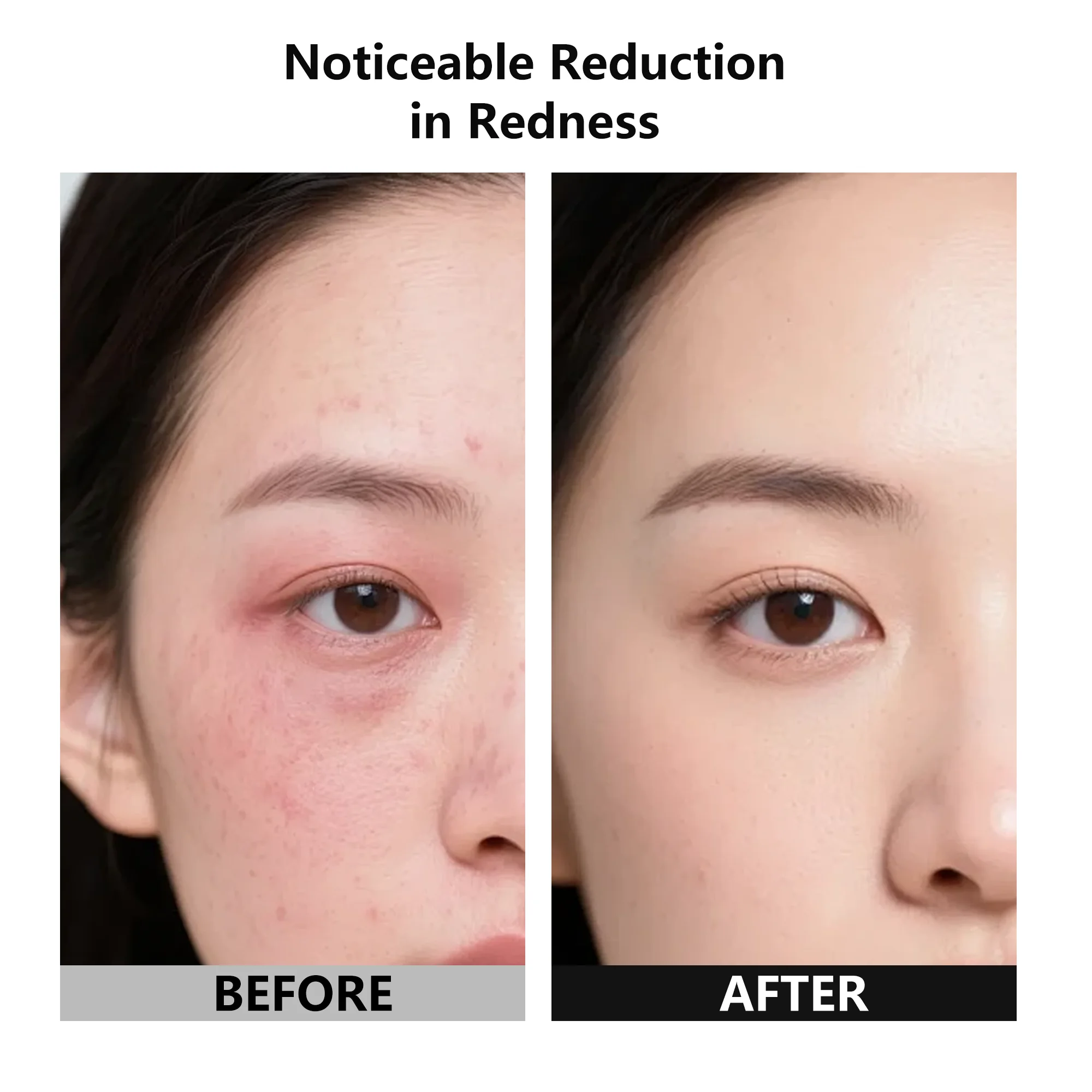 3つのモード（赤/紫/オレンジ+赤外線）を備えたLED美容マスクは、細かい線を軽減/皮脂コントロール/様々な肌タイプの肌を明るくします