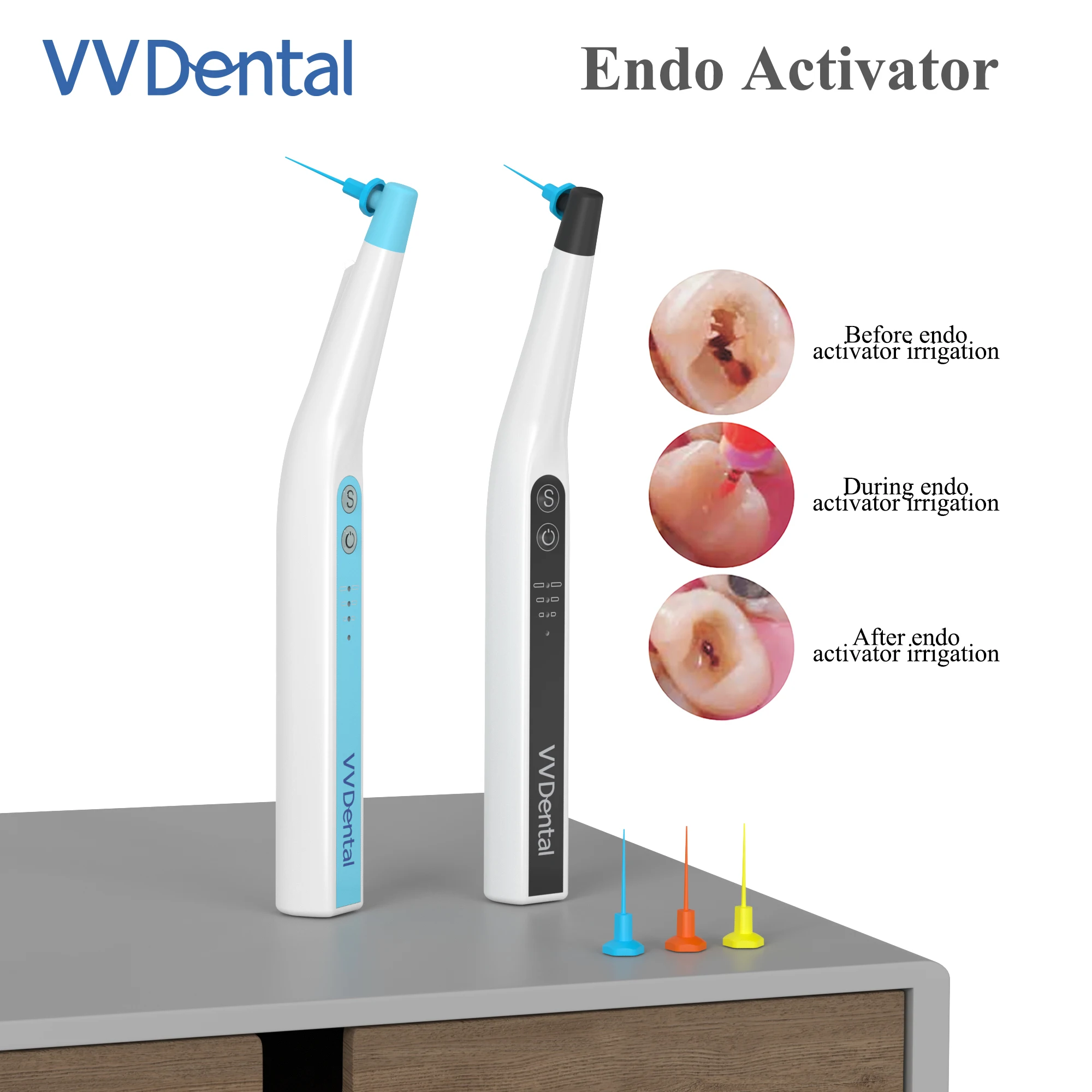 VV Dental Ultrasonic Endo Irrigator Root Canal with LED Light Tip for Dentistry Endodontic Locator Sonic Irrigator Endodontic