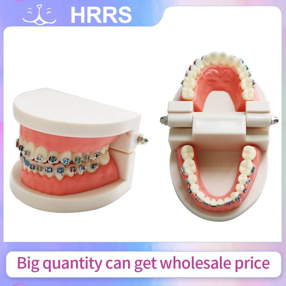 

Модель зубных зубов с металлическим кронштейном, проволокой, буккальной трубкой, резиновой стяжкой