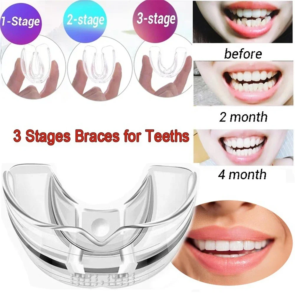 Sdottor 3 stadi dente in Silicone Set ortodontico invisibile apparecchio dentale fermo per denti paradenti bretelle vassoio per denti dente Ca