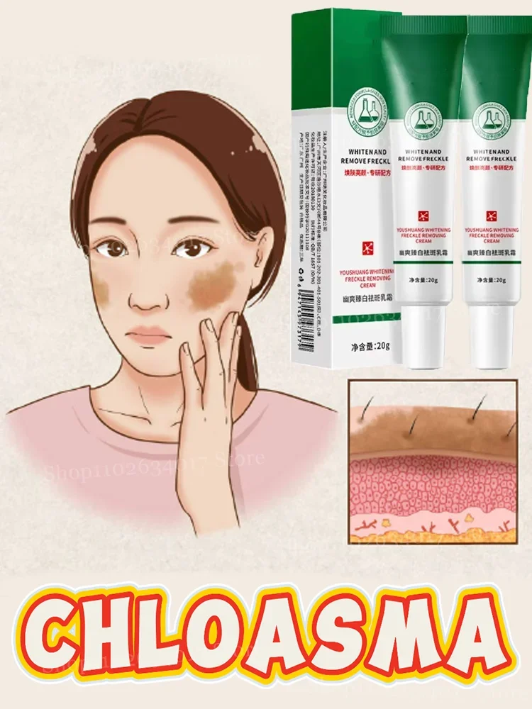 Professional melasma has a trick.Cream