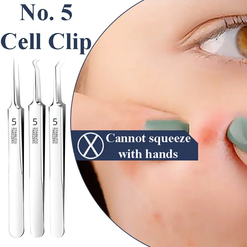 الملقط الألمانية فائقة الدقة خلية البثور البثرة كليب الملقط صالون تجميل خاص كشط إغلاق قطعة أثرية حب الشباب إبرة أداة