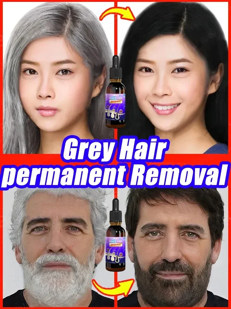 Hair Growth Anti Whitening essence for Treatment of White  to Black and White  Natural Repair Nourishing Care Produ