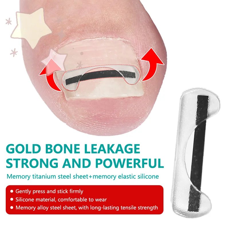 سلك تصحيح أظافر القدم من سبائك التيتانيوم لعلاج الأظافر نام مع ملصقات أداة السيليكون ملحقات العناية بالقدم