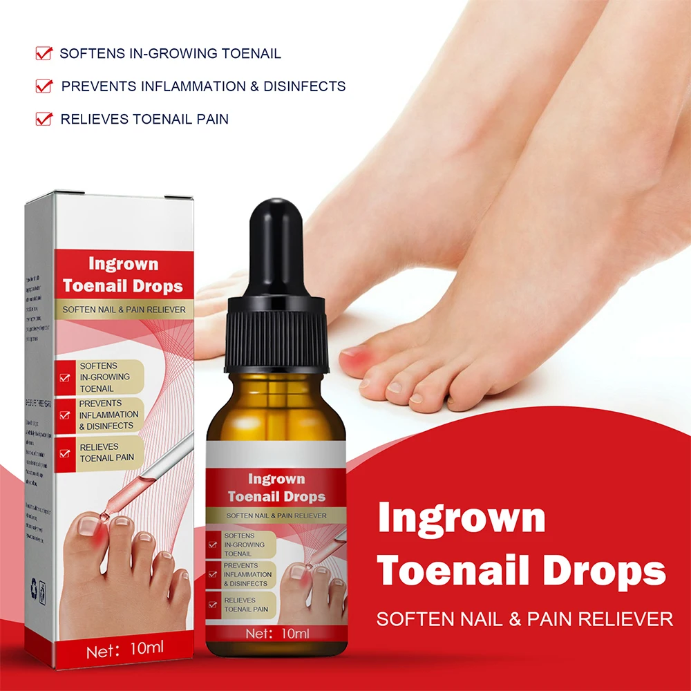 Nagel Reparatie Essence Onychomycosis Nagel Schimmel Laserbehandelingsapparaat Anti Infectie Paronychia Ingegroeide Teennagel Voetverzorging Apparaat