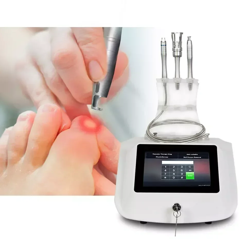 

Spider Vein Removal Vascular Treatment Onychomycosis Toe Nail Fungus Treatment high frequency rf spider vein removal machine