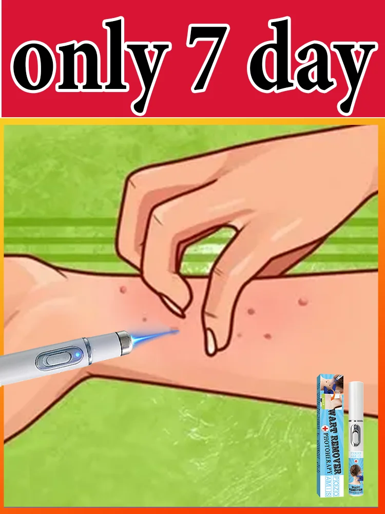 

Gᴇɴᴇʀᴀᴛɪᴏɴ-3 Lᴀsᴇʀ Sᴀʏs Gᴏᴏᴅʙʏᴇ Tᴏ Wᴀʀᴛs Iɴ 7 Dᴀʏs