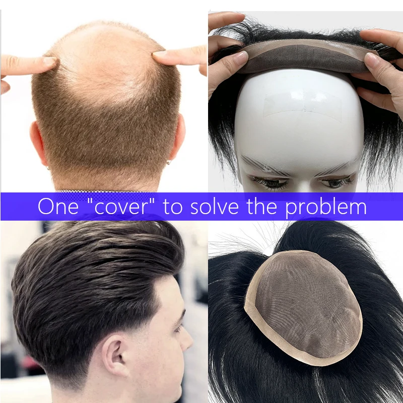 100% Human Hair Men Top Wig Make A Hairstyle At Will Natural Breathable Wig Thinning Hair Cover-Up Forehead Balding Concealment