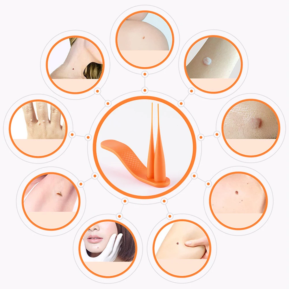 2 In 1 ชุดกําจัดผิว MINI Mole Wart เครื่องมือผิว Facial Mole Wart Remover ทําความสะอาดผ้าฝ้าย Swab Facial Care เครื่องมือแบบพกพา
