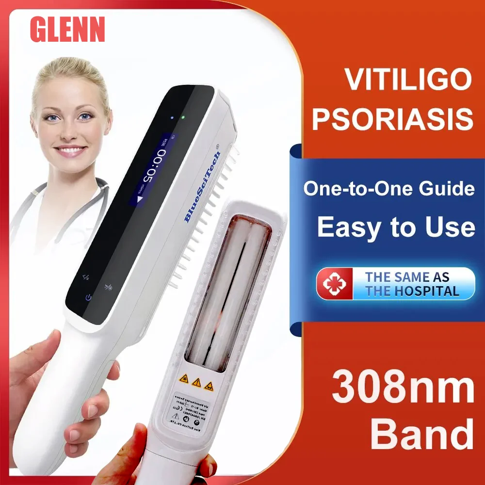 Casa Vitiligo Ultravioleta Fisioterapia Instrumento, Psoríase Therapy Device, White Spot Luz Tratamento, 308nm