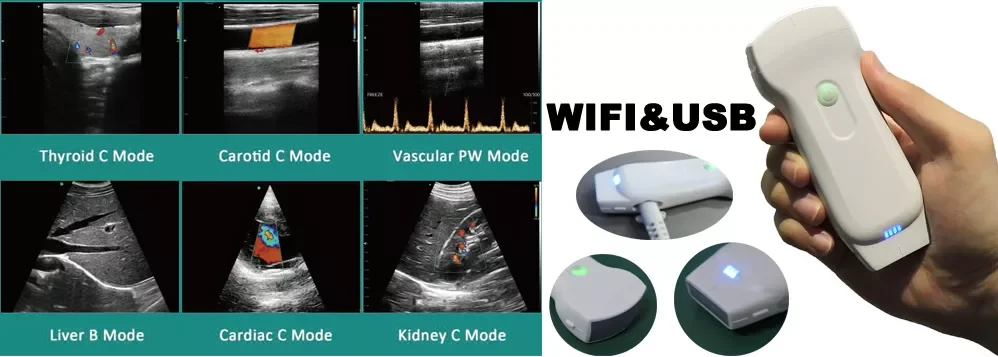 

Зонды 128-элементный ультразвуковой сканер Ветеринарный портативный беспроводной цветной допплеровский ультразвуковой выпуклый, линейный и карадический