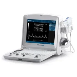 Edan ultrasound machine edan dus 60