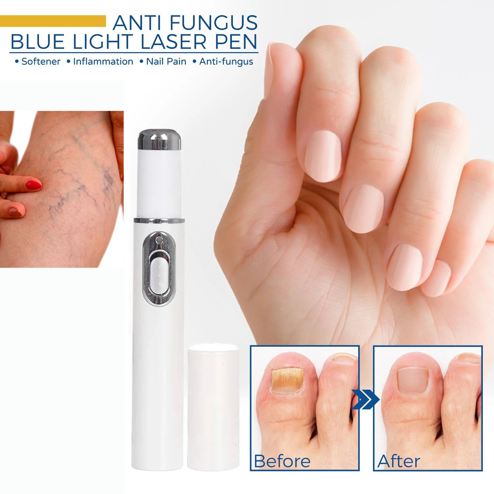 

Устройство для красоты лица Массажер для глаз Синий свет Черные круги для глаз Инструмент для ухода за лицом Осветляющая текстура Поддержание мешков под глазами Здоровье