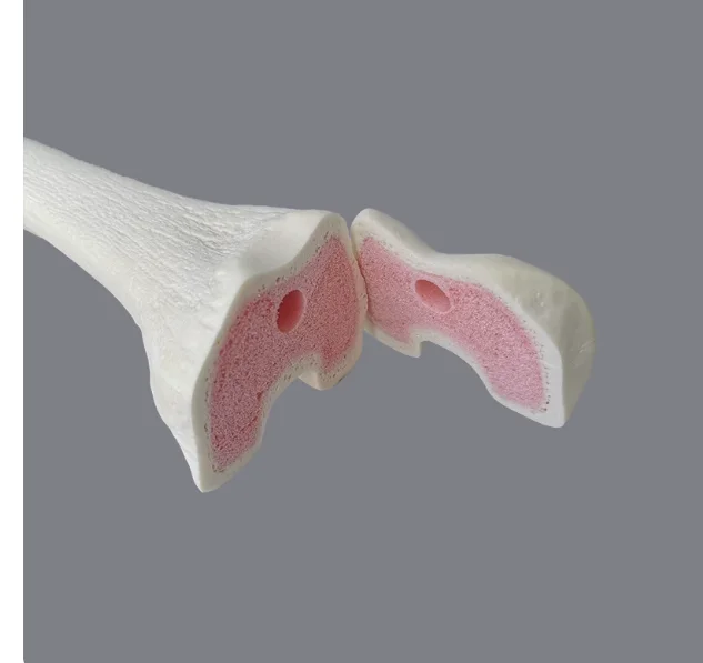 Simulated Human Femur Bone Model, Synthetic Pseudobone for Orthopedic Surgical Training Practice