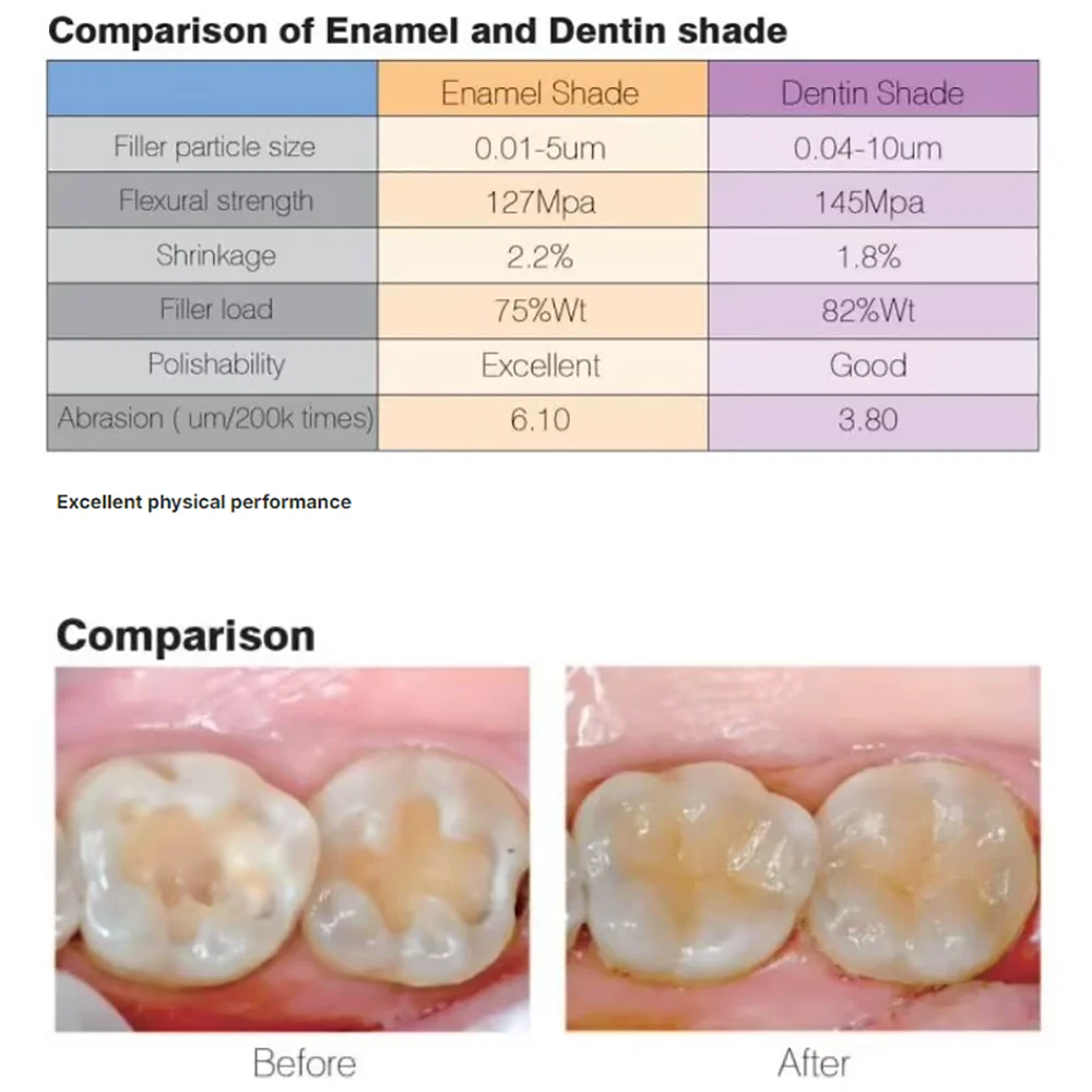 Dentex Dental Nano Hybrid Light Cure Composite Nanocomposite Bulk Fill Posterior Restorative Curing Composite Resins High Streng