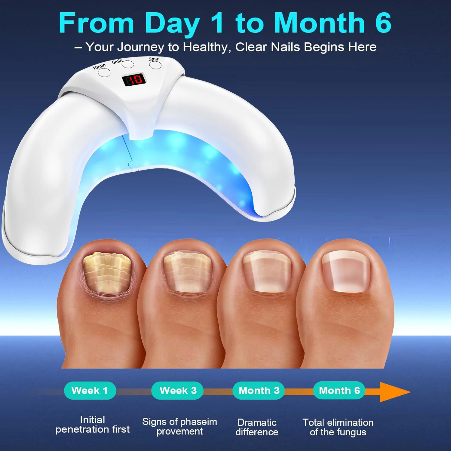 Nail Laser Fungus Device for Multiple Toenails & Fingernails Nail Repair Solution for Damaged and Discolored Nails for Home Use