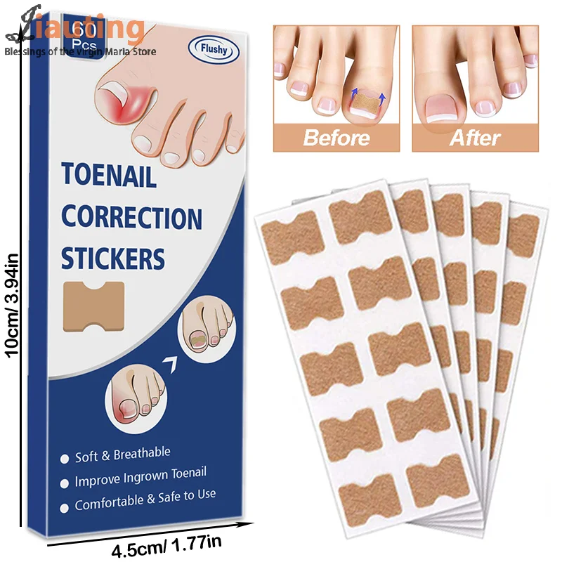 60Pcs Ingrown Nail Correction Stickers Toenail Corrector Patches Paronychia Treatment Recover Corrector Pedicure Nail Care Tool