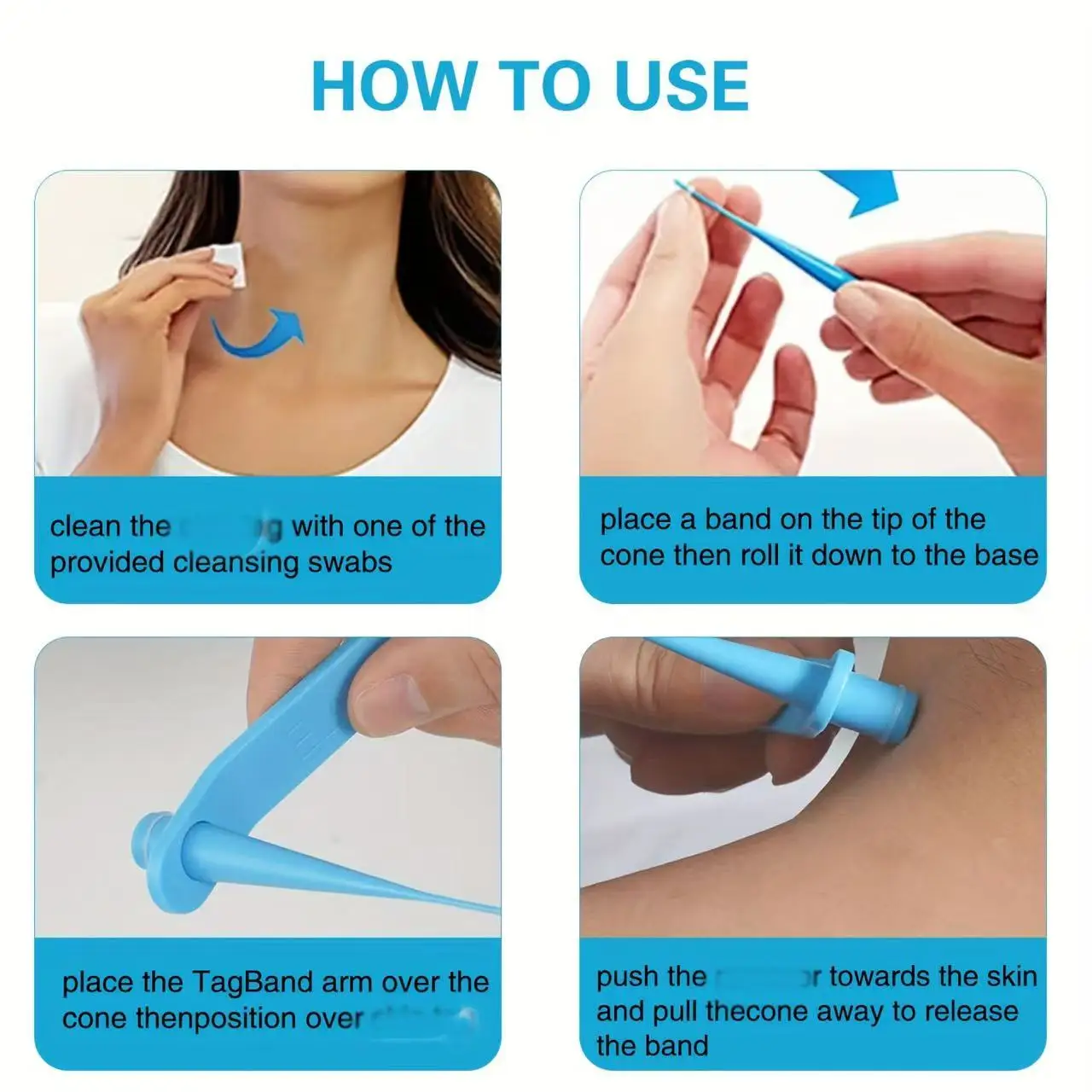 Kit de remoção de verrugas com etiqueta de pele 3 em 1, ferramenta de cuidados de beleza para toupeira automática indolor com cotonetes de limpeza para cuidados de beleza facial