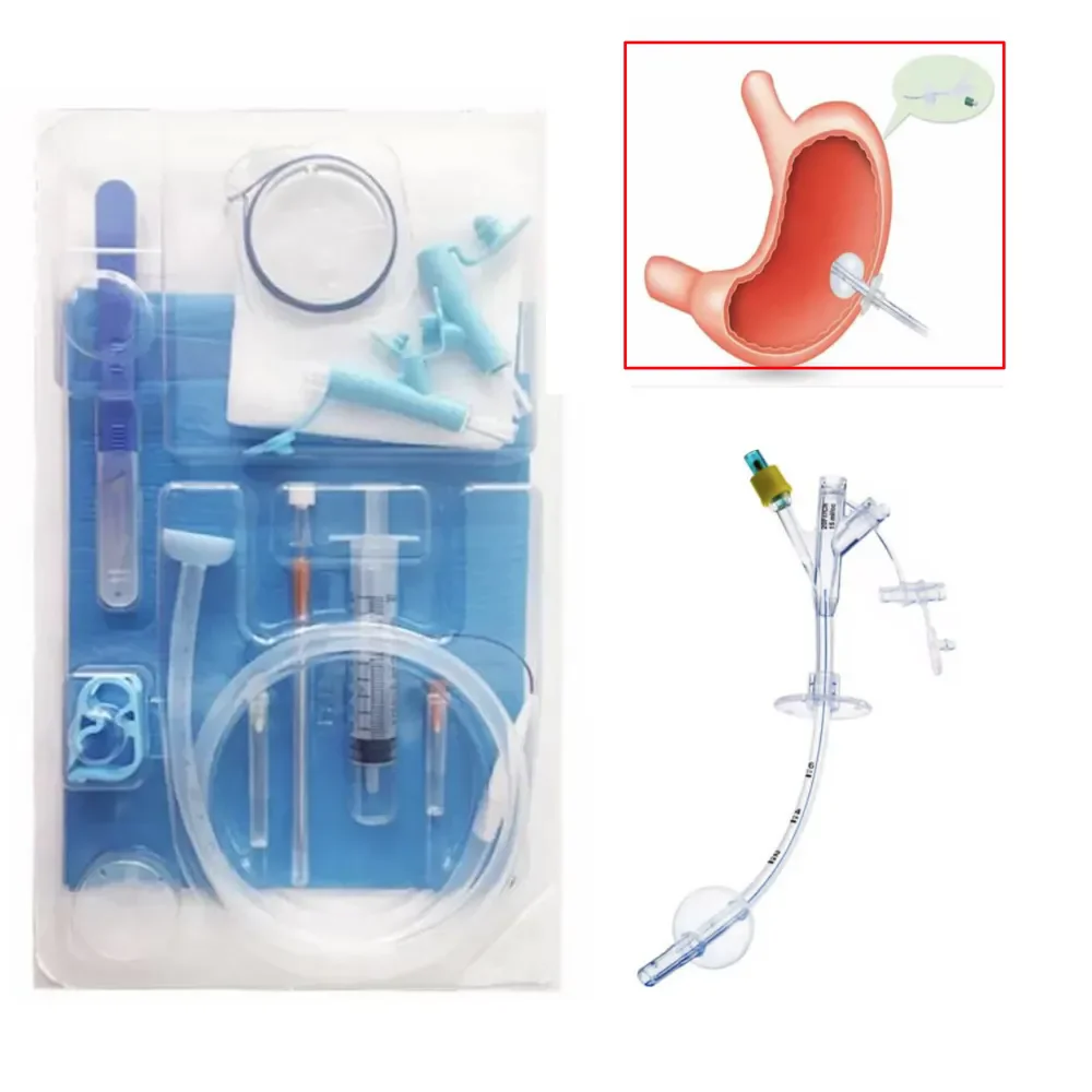 

Disposable PEG kit 24Fr