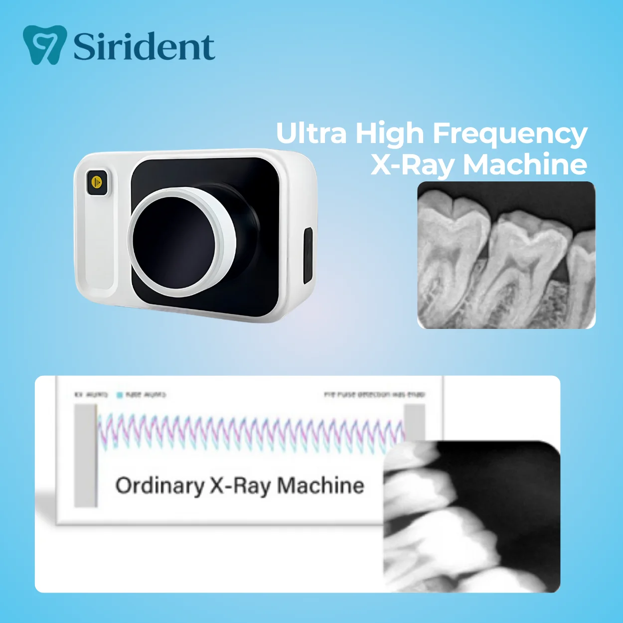 

Dental X Ray Machine Portable High Frequency Wireless X-Ray Imaging System Dental Equipment Digital Sensor Dentist Tools