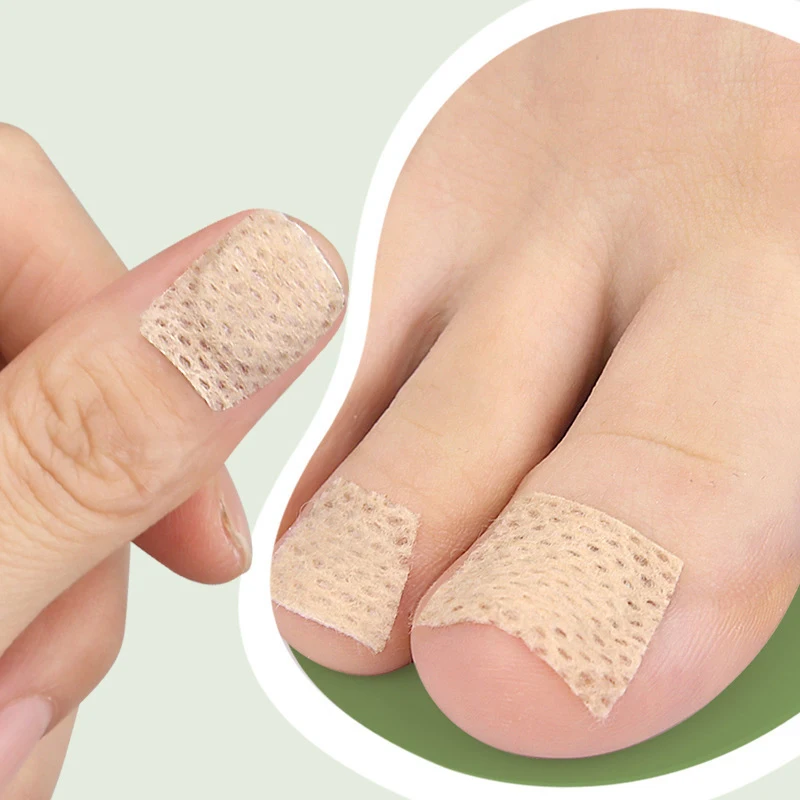 Nail Care Patch Ingrown Toenail Toe Pad Orthopedic Patch Soft Nail Onychomycosis Nail Repair Patch