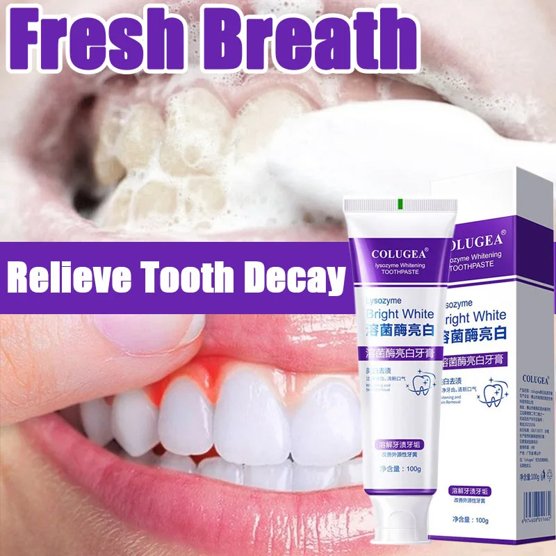

Whiten Teeth Toothpaste Prevent Tooth Decay Maintain Fresh Breath Remove Tooth Stains With Toothpaste Remove Tartar Oral Care