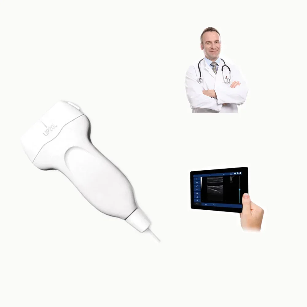 

High Quality Latest Portable Smartphone Ultrasound Machine USB Probe Price