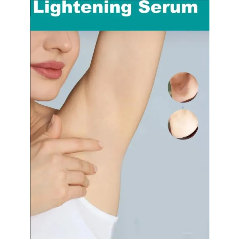 Skin Whitening Essence for Private Parts Buttocks Armpit Hip Knee Thigh Inner Melanin Removal Brightening Serum