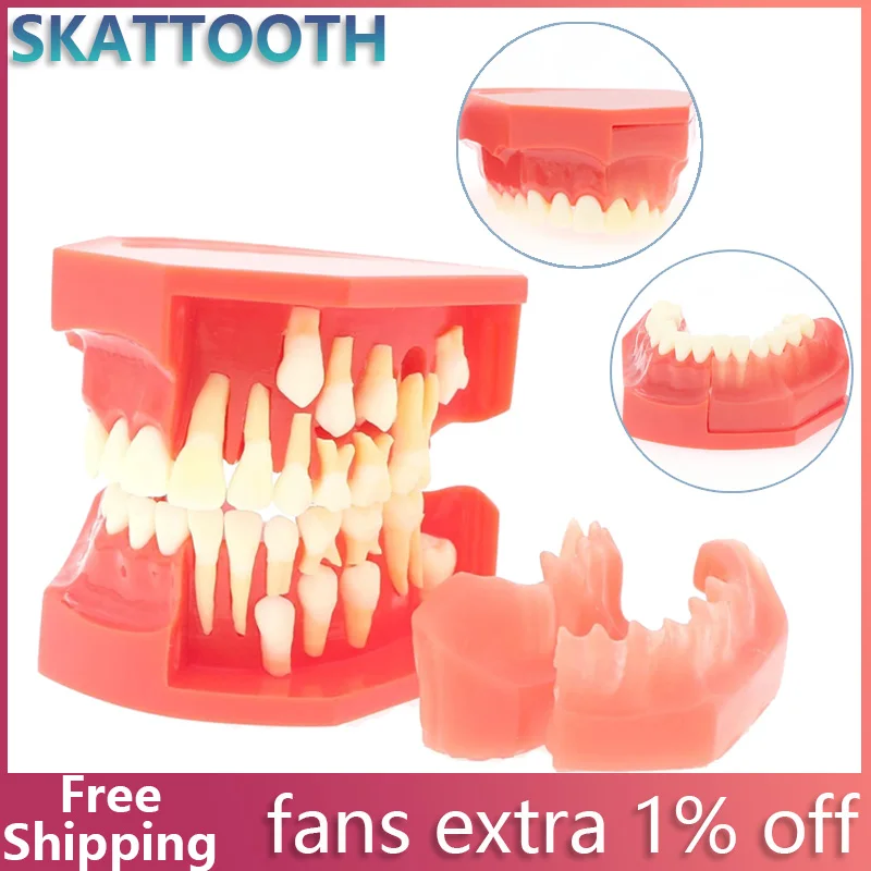 Dental Model Children's Primary and Permanent Teeth Alternate Model Deciduous Teeth Replacement  Development Demonstration Model