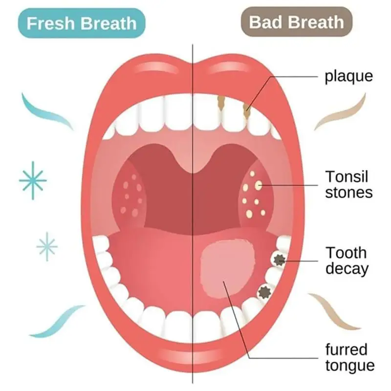 Sp-7 Dentifricio probiotico Rimozione dell'alito cattivo Macchie di denti gialli Illumina il sbiancamento Alito fresco Prodotto per la gestione della salute orale