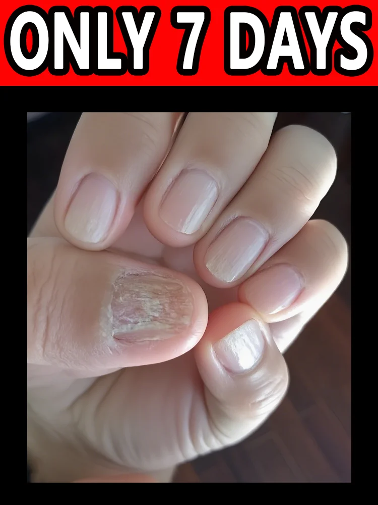 

Новое поколение инструментов для ухода за ногтями, безболезненная замена ногтей.