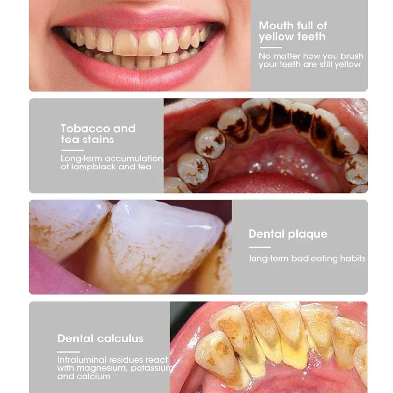 3 IN 1 spazzolino da denti Sonic Dental Kit di sbiancamento dei denti sbiancante per denti tartaro strumenti di rimozione del tartaro detergente macchia igiene orale