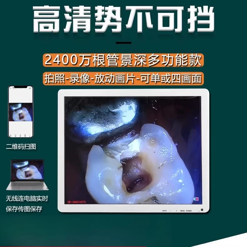 Oral observer tooth photo high definition touch screen computer all-in-one machine
