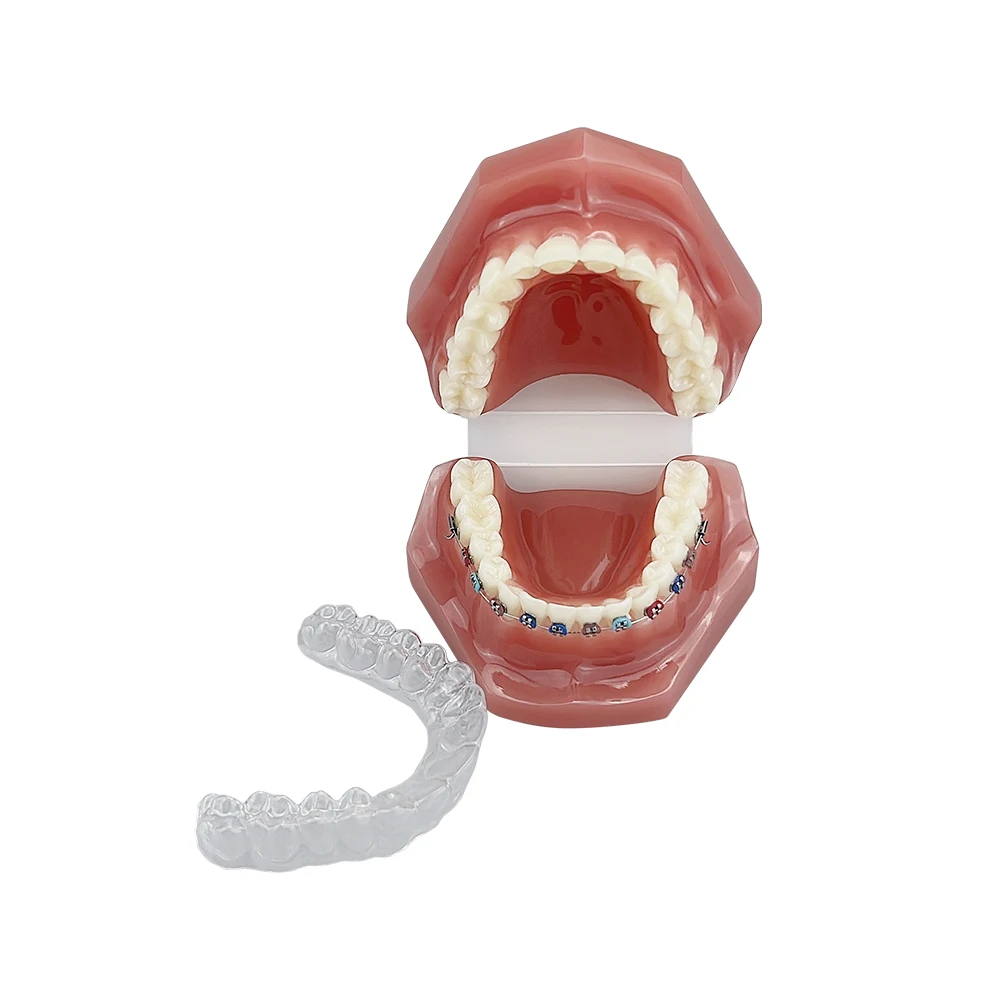 Orthodontic Model Teeth Clear Aligners Invisible Dental Orthodontic Teeth Model With Braces  For Studying Teaching Demonstration