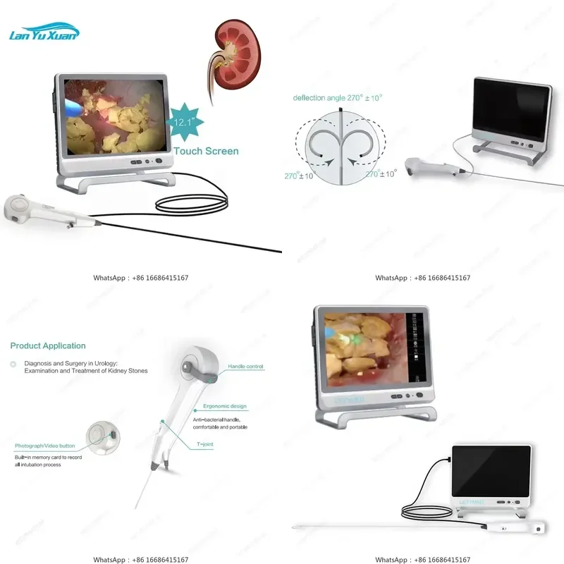 7.5fr 9.5fr Flexible Disposable Ureteroscope Disposable Urology Digital Video Ureterorenoscope 2.5mm 2.8mm