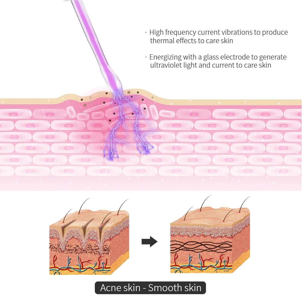 Thumbnail 3 - #59 Electric Facial Massagers Price Drop Alerts