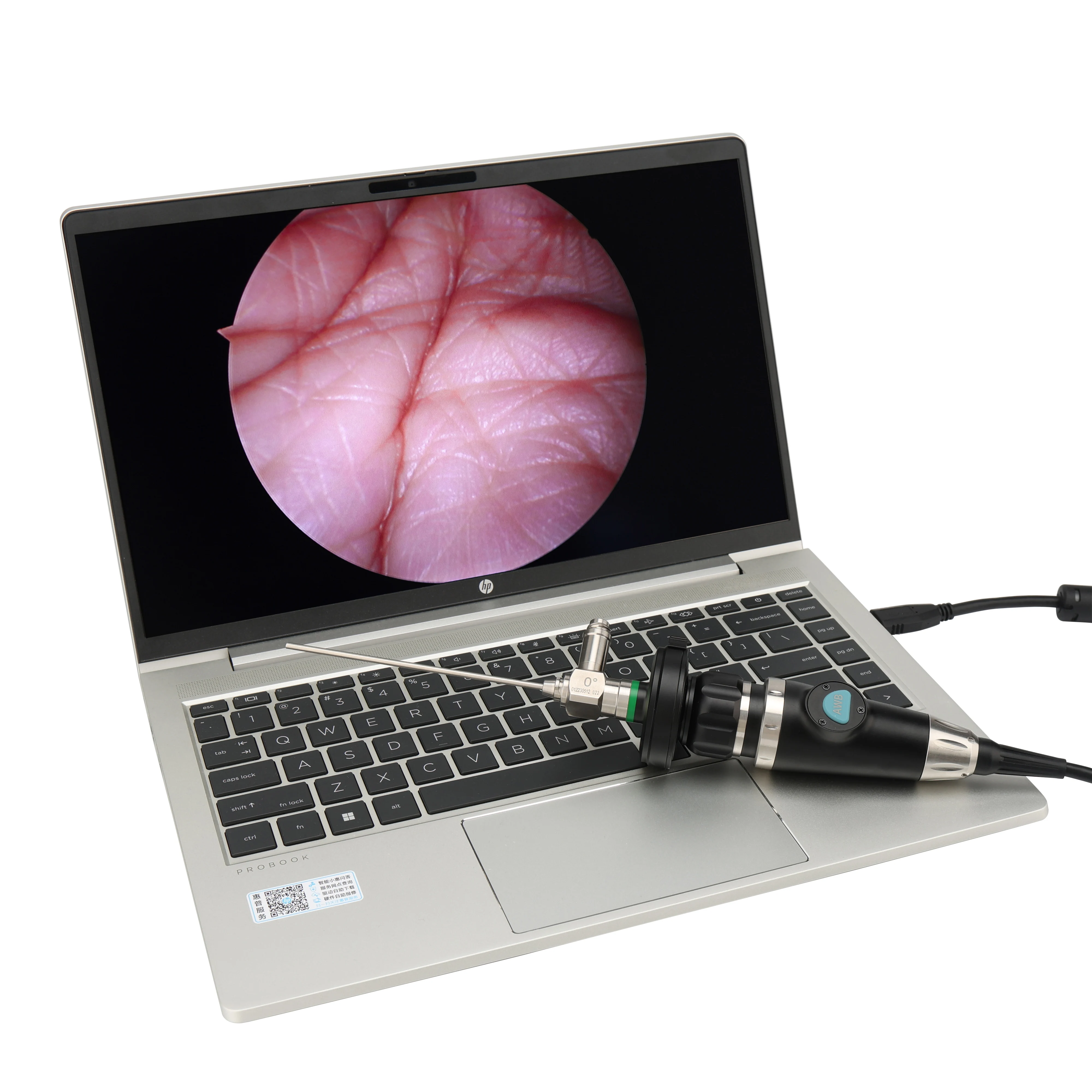 Hd Medische Endoscopie Hd Usb Endoscoop Camera Hoge Resolutie Volledige Endoscopie Camera