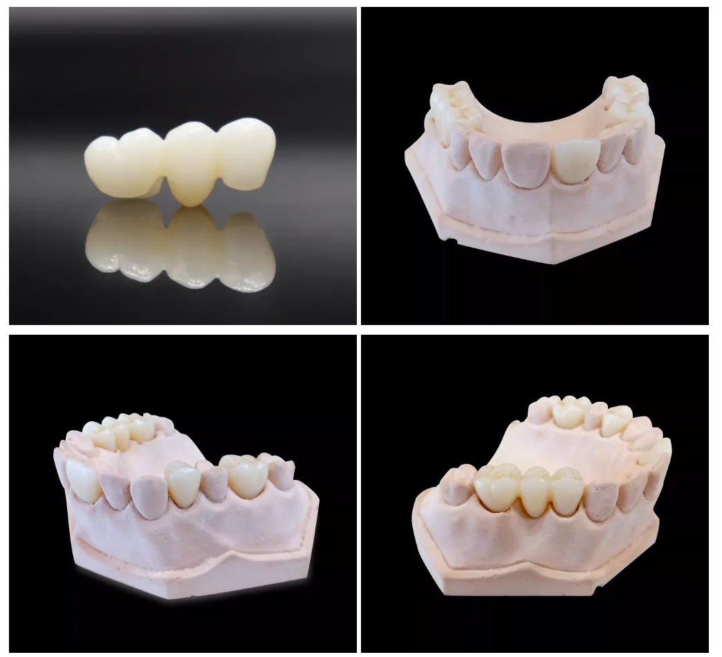 98*20mm Zirconia Cad Cam 98 Open System Dental Lab White Zirconium Ceramic Block