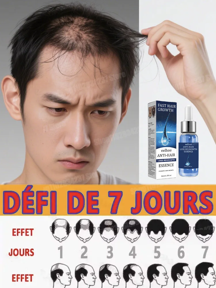 

Fast Hair Growth Oil Effective Baldness Repair Hereditary Hair Loss Postpartum Seborrheic Hair Anti Loss