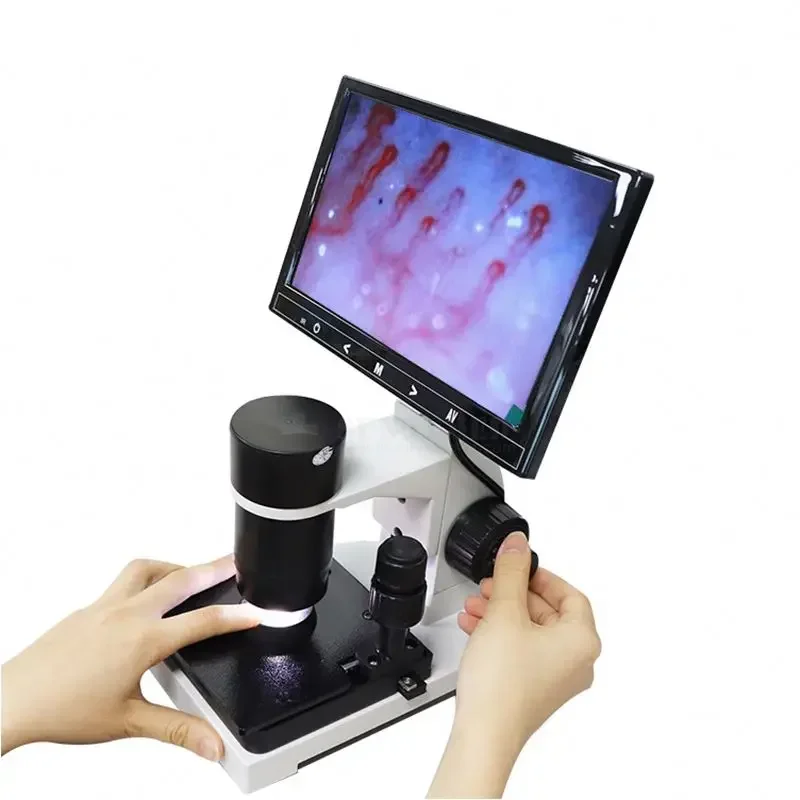 Flow Rate Observation Microscope Finger Terminal Vascular Capillary Microcirculation Microscopy SY-B198