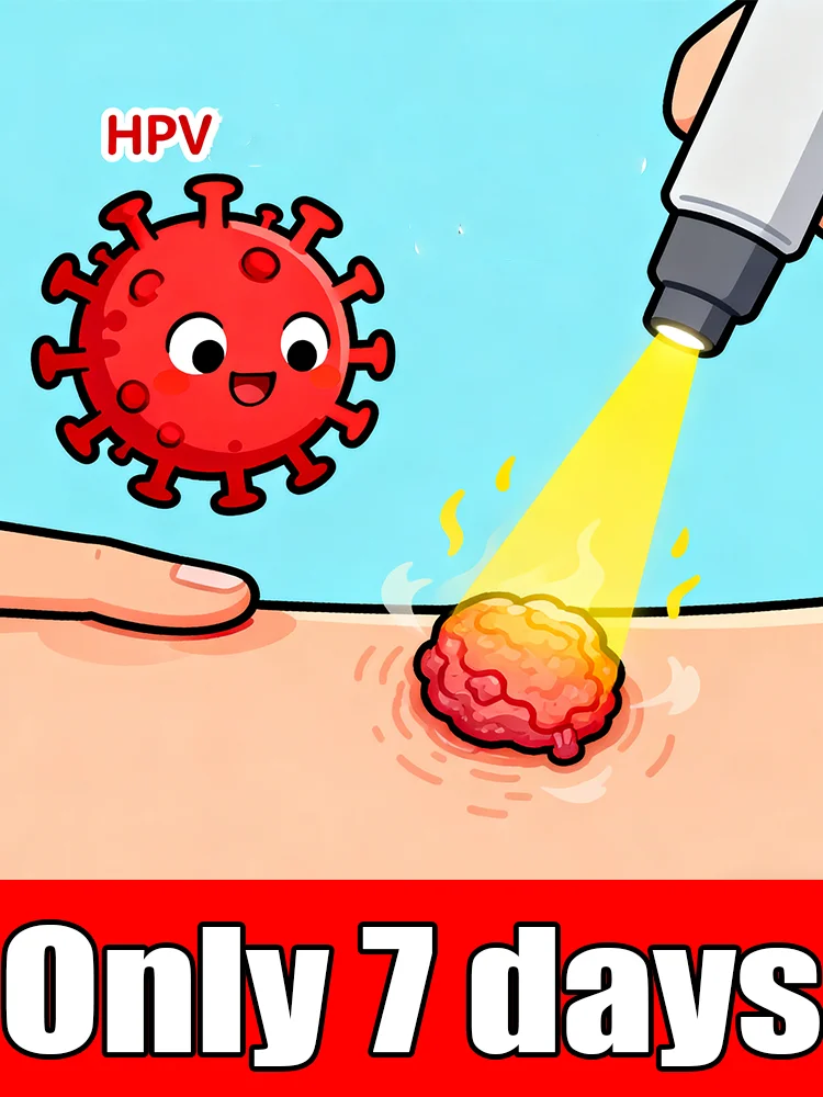 Hᴏᴛ sᴇʟʟɪɴɢ ʙʟᴜᴇ ʟɪɢʜᴛ ᴘᴇɴ ᴛᴏ sᴏʟᴠᴇ ʙᴏᴅʏ ᴡᴀʀᴛs, ᴡᴀʀᴛ ᴄᴀʀᴇ ᴛᴏᴏʟs