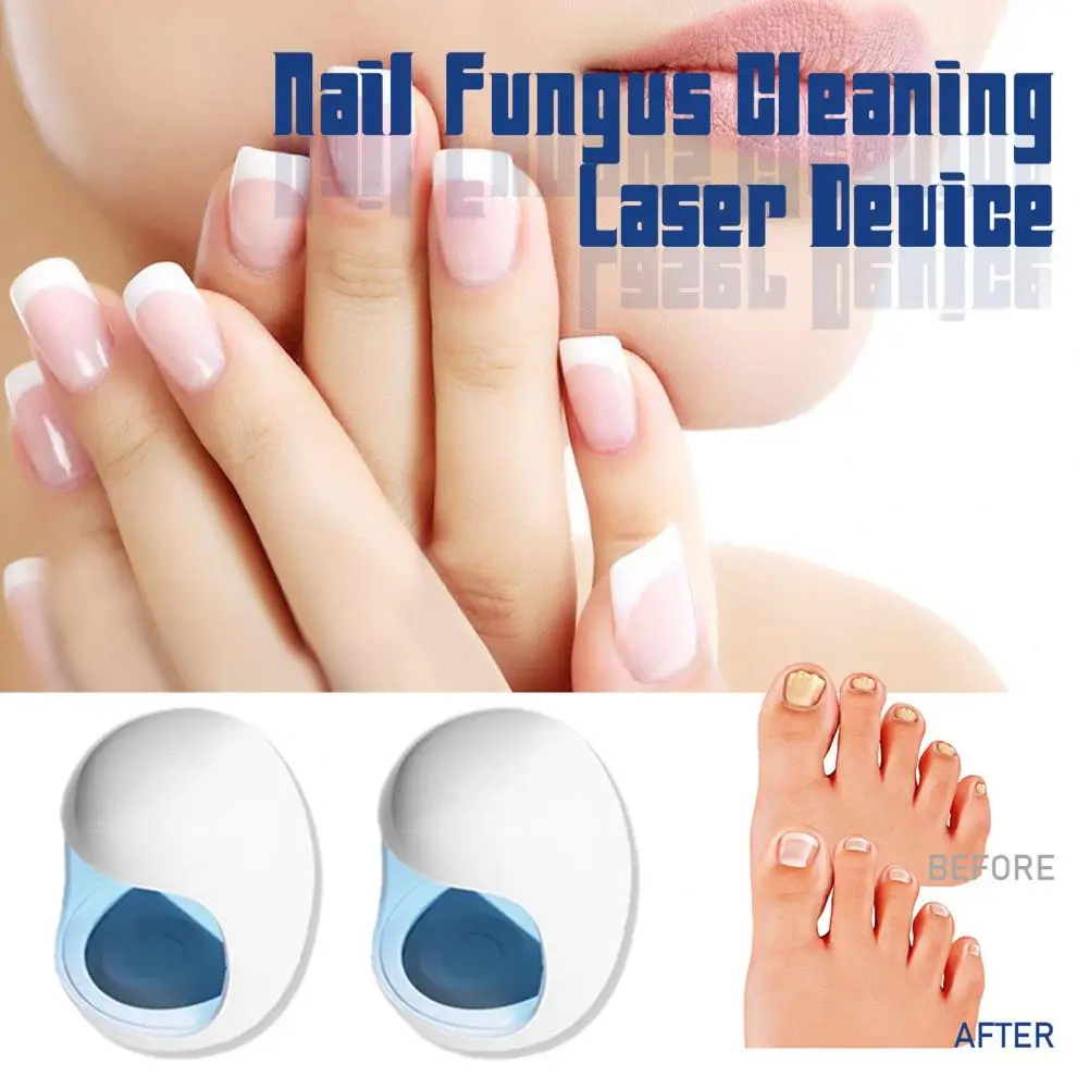 Nail Fungus Laser Blue Light Therapy Nail Fungus Device Infrared Cold Lasers Nail Care Device Toenail Fingernail Treatment