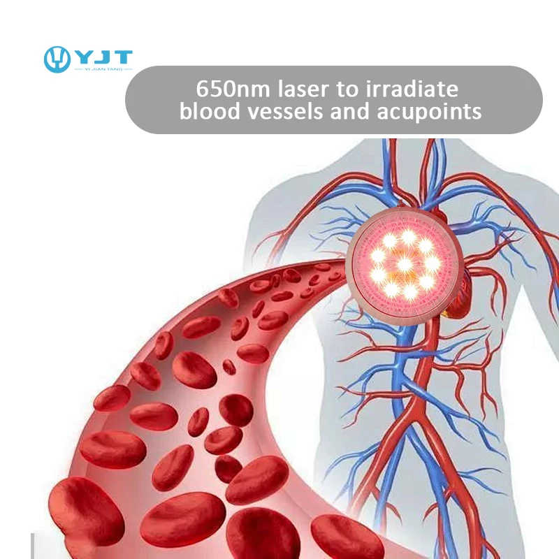 2026 Latest 650nm Laser Treatment Watch Photonic Therapy Device for Hemodynamics Pain Relief Improvement and Systemic Inflammati