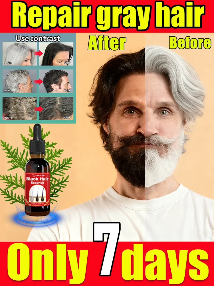 

White to Black Hair Serum Gʀᴀʏ Hᴀɪʀ Tʀᴇᴀᴛᴍᴇɴᴛ Nᴀᴛᴜʀᴀʟ Cᴏʟᴏʀ Rᴇᴘᴀɪʀ Nᴏᴜʀɪsʜɪɴɢ Aɴᴛɪ-Hᴀɪʀ Lᴏss Cᴀʀᴇ Mᴇɴ Wᴏᴍᴇɴ