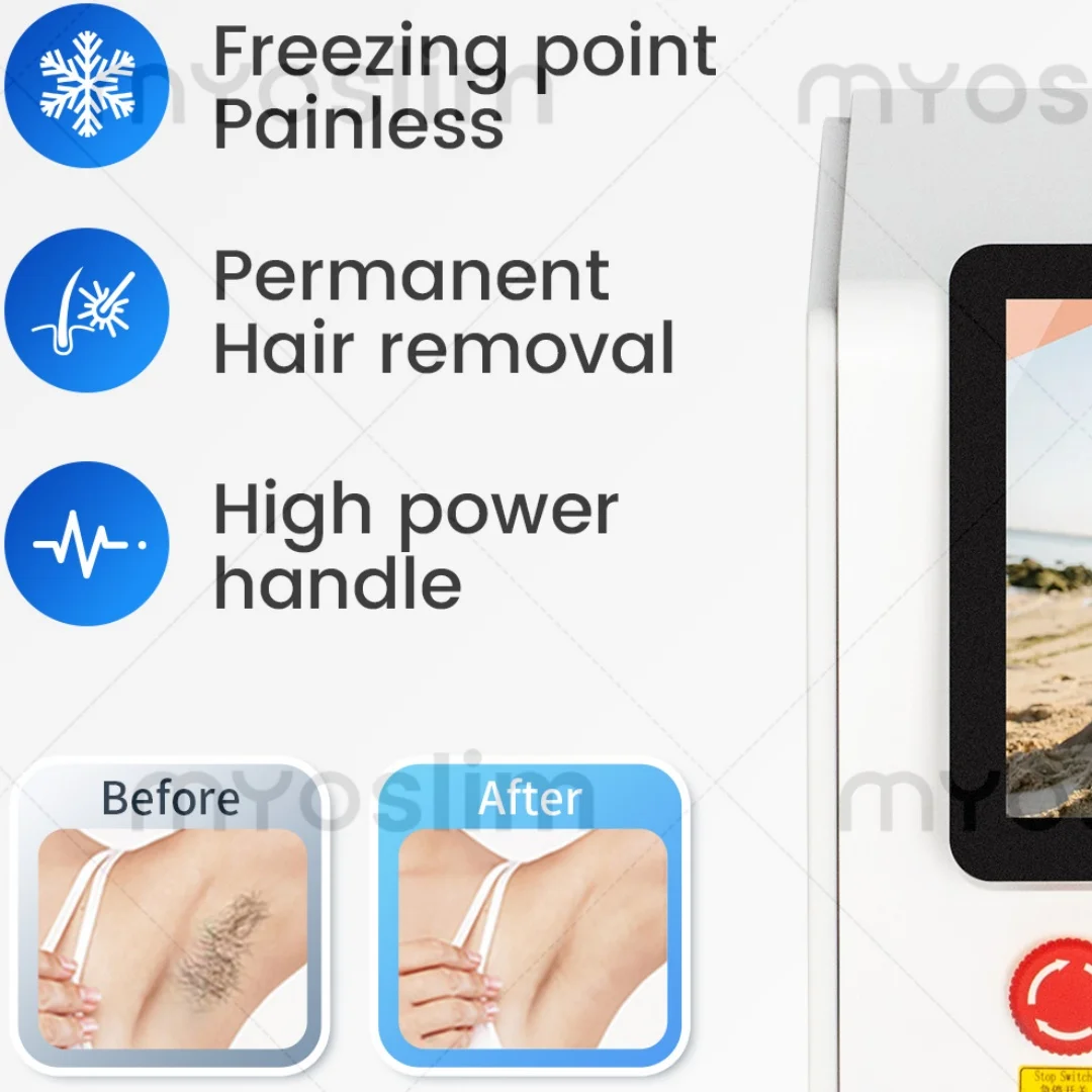 

Профессиональная диодная лазерная система для удаления волос 808 нм, 10 баров, быстрое и безболезненное лечение, оборудование для салонов красоты