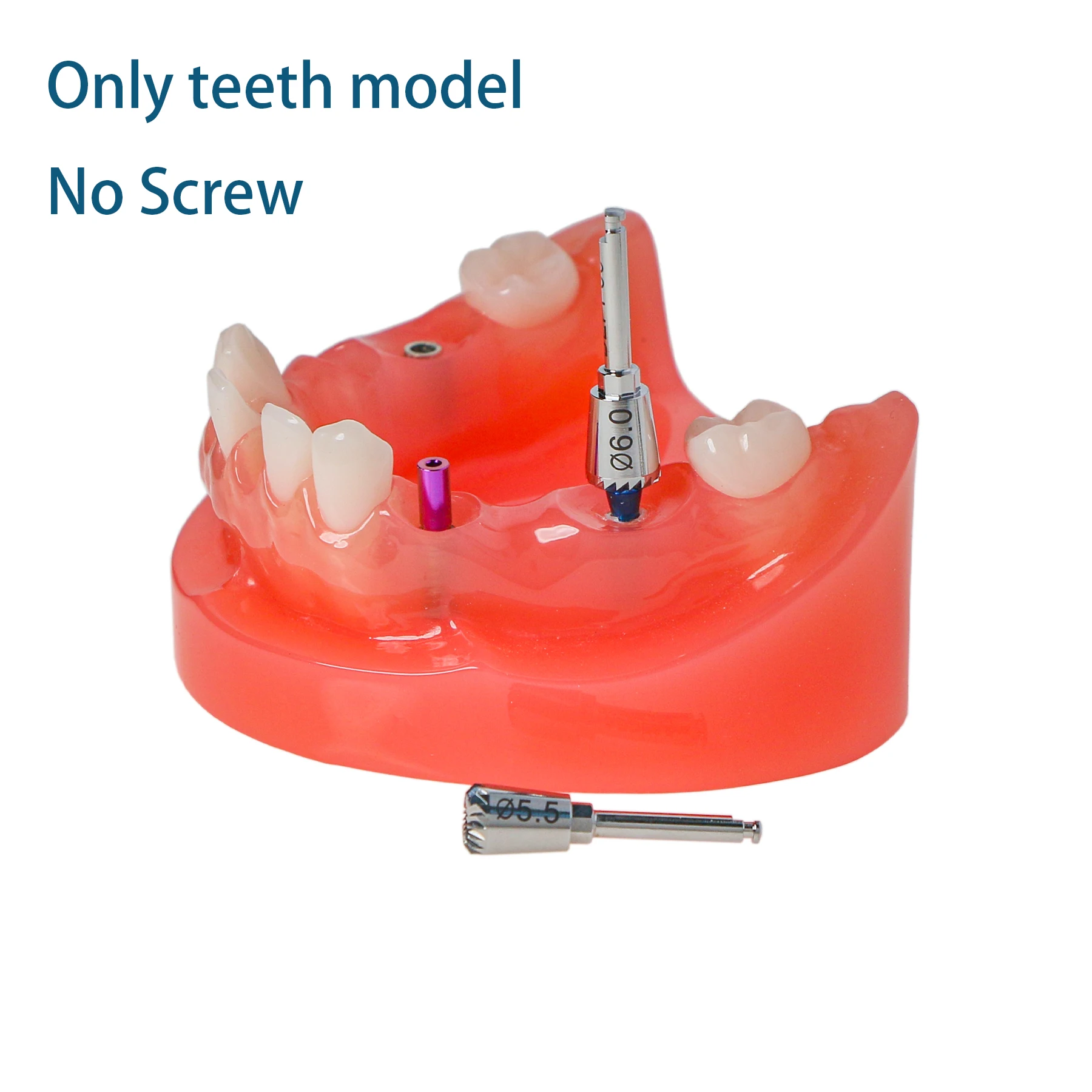 

Dental Typodont Implant And Restpration Model With 4 Screws Low Jaw Type M6019