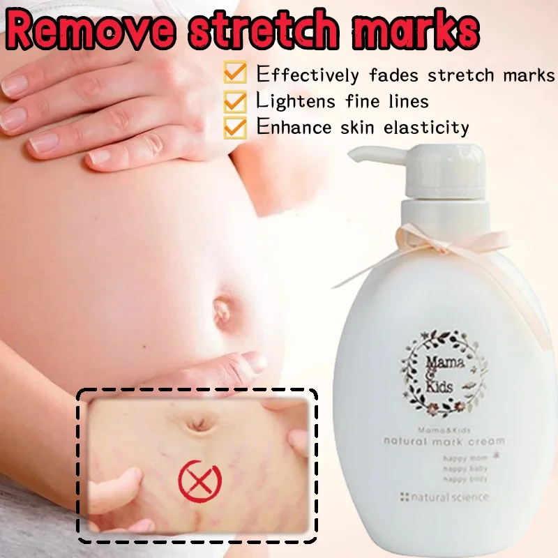 

Plant Essence Non-irritating Mother's First Choice Anti-stretch Mark Moisturizing Cream To Reject Stretch Marks 470g