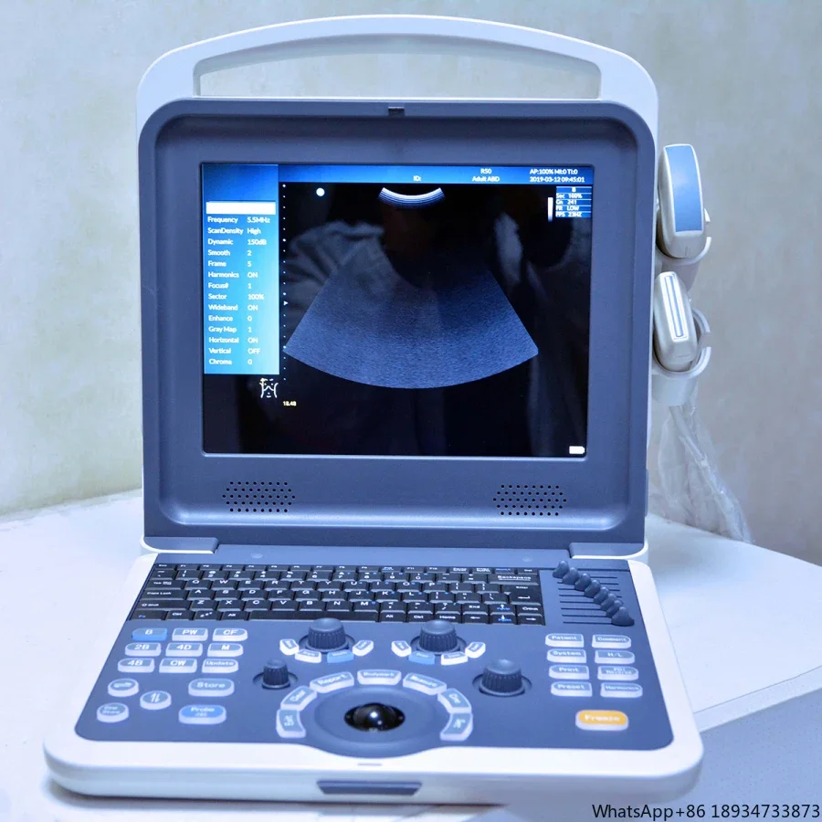 2d /3d/4d medical ultrasound machine